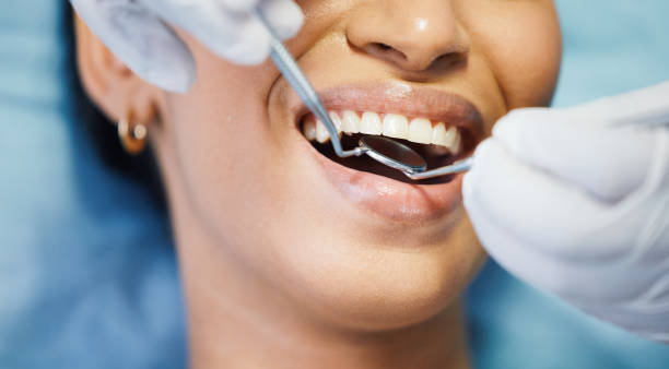 Best Emergency Root Canal Therapy in Buies Creek, NC